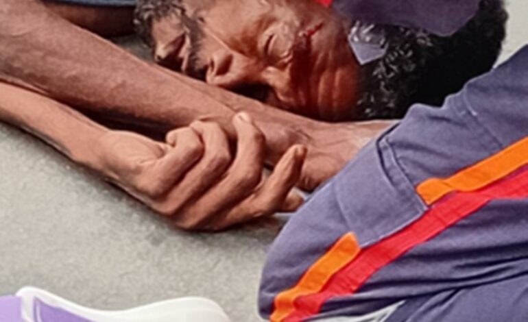  Motociclista que atropelou homem no bairro Bela Vista se apresenta a polícia